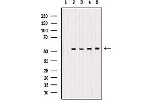 Western blot analysis of extracts from various samples, using PDHX Antibody.
