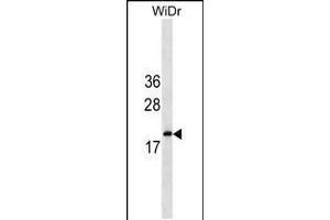 Western blot analysis in WiDr cell line lysates (35ug/lane). (IFNA5 Antikörper  (C-Term))