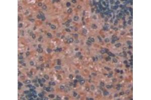 Immunohistochemistry (IHC) image for anti-CD14 (CD14) (AA 18-372) antibody (ABIN1858288)