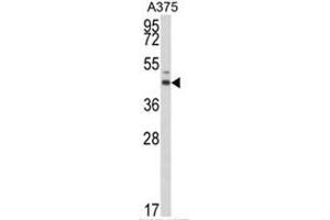 Western blot analysis of ESRRA Antibody (Center) in A375 cell line lysates (35ug/lane). (ESRRA Antikörper  (Middle Region))