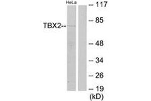 Western blot analysis of extracts from HeLa cells, using TBX2 Antibody. (TBX2 Antikörper  (AA 251-300))