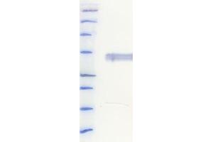 Western Blotting (WB) image for anti-His Tag antibody (ABIN6252928)