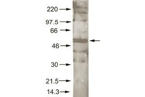 Immunoblotting. (AKT1 Antikörper  (C-Term))
