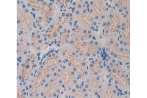 Used in DAB staining on fromalin fixed paraffin- embedded kidney tissue