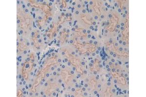 Used in DAB staining on fromalin fixed paraffin- embedded kidney tissue (ABCB9 Antikörper  (AA 500-762))