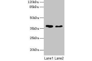 Western blot All lanes: AGA antibody at 10 μg/mL Lane 1: 293T whole cell lysate Lane 2: Mouse muscle tissue Secondary Goat polyclonal to rabbit IgG at 1/10000 dilution Predicted band size: 38 kDa Observed band size: 38 kDa (AGA Antikörper  (AA 206-346))