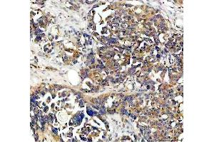 IHC analysis of NQO1 using anti-NQO1 antibody (ABIN7599200). (NQO1 Antikörper  (AA 1-274))