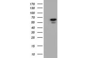Image no. 6 for anti-Adenylate Kinase 5 (AK5) antibody (ABIN1496535) (Adenylate Kinase 5 Antikörper)