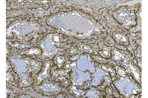 IHC analysis of EHD3 using anti-EHD3 antibody (ABIN7602777). (EHD3 Antikörper  (C-Term))