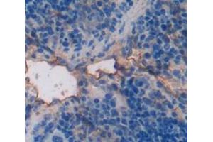 IHC-P analysis of Mouse Tissue, with DAB staining. (PIM2 Antikörper  (AA 98-319))