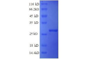 Mannose-Binding Lectin (Protein C) 2, Soluble (MBL2) (AA 26-248), (partial) protein (His tag) (MBL2 Protein (AA 26-248, partial) (His tag))