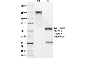 SDS-PAGE Analysis Purified Bcl-2 Mouse Monoclonal Antibody (8C8). (Bcl-2 Antikörper  (AA 41-54))