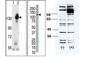 (LEFT) Western blot analysis of CSF1R (arrow) using rabbit polyclonal CSF1R Antibody (C-term). (CSF1R Antikörper  (C-Term))