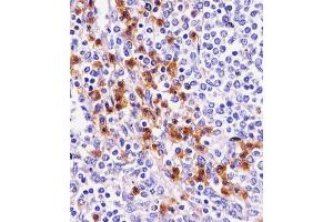 Antibody staining D11b in human spleen tissue sections by Immunohistochemistry (IHC-P - paraformaldehyde-fixed, paraffin-embedded sections).