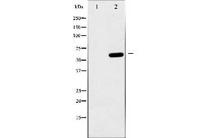 Western blot analysis of AMPK1 phosphorylation expression in heatshock treated HeLa whole cell lysates,The lane on the left is treated with the antigen-specific peptide. (PRKAA1 Antikörper  (pSer486))