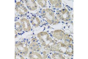 Immunohistochemistry of paraffin-embedded human gastric using ST8SIA2 antibody at dilution of 1:100 (x40 lens).