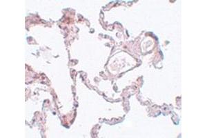 Immunohistochemical staining of hman lung tissue with PLEKHM1 polyclonal antibody  at 5 ug/mL dilution. (PLEKHM1 Antikörper  (N-Term))
