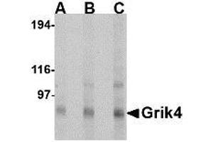 Image no. 1 for anti-Glutamate Receptor, Ionotropic, Kainate 4 (GRIK4) (N-Term) antibody (ABIN1494379) (GRIK4 Antikörper  (N-Term))