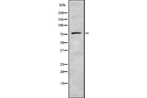 Western blot analysis GCS alpha-1 using LOVO whole cell lysates (GUCY1A1 Antikörper  (C-Term))