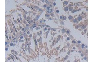 Detection of MUC20 in Rat Testis Tissue using Polyclonal Antibody to Mucin 20 (MUC20) (MUC20 Antikörper  (AA 113-347))