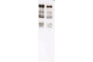 Immunoblot of Ubiquitin. (Ubiquitin Antikörper)