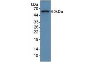 Detection of COL8a1 in Human Hela Cells using Polyclonal Antibody to Collagen Type VIII Alpha 1 (COL8a1) (COL8A1 Antikörper  (AA 590-744))