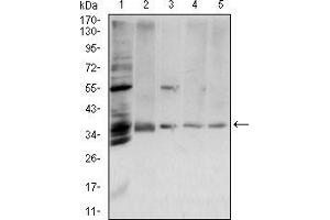 Western Blotting (WB) image for anti-Annexin A5 (ANXA5) (AA 160-320) antibody (ABIN5542267)