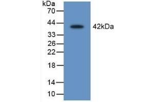 Detection of Recombinant LEI, Rat using Polyclonal Antibody to Leukocyte Elastase Inhibitor (LEI) (SERPINB1 Antikörper  (AA 17-332))