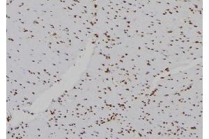 Immunohistochemistry (IHC) image for anti-Histone H2B Type 2-E (HIST2H2BE) (C-Term) antibody (ABIN6262244)