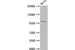 Western Blot Positive WB detected in: Hela whole cell lysate All lanes: NPC1 antibody at 3 μg/mL Secondary Goat polyclonal to rabbit IgG at 1/50000 dilution Predicted band size: 143, 108 kDa Observed band size: 108 kDa