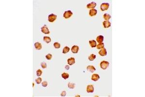 Immunohistochemistry (IHC) image for anti-Tumor Necrosis Factor Receptor Superfamily, Member 10d, Decoy with Truncated Death Domain (TNFRSF10D) (Cytoplasmic Domain) antibody (ABIN1030842)