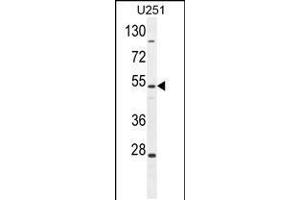 Western blot analysis in U251 cell line lysates (35ug/lane). (ZIK1 Antikörper  (AA 186-215))