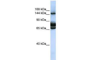 WB Suggested Anti-FAM83B Antibody Titration: 0. (FAM83B Antikörper  (C-Term))