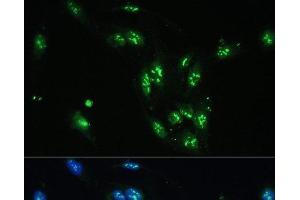 Immunofluorescence analysis of U-2 OS cells using CCDC59 Polyclonal Antibody at dilution of 1:100. (CCDC59 Antikörper)