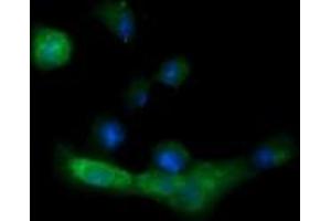 Image no. 5 for anti-Melan A (MLANA) antibody (ABIN1499424) (MLANA Antikörper)