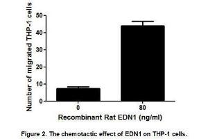 Image no. 2 for Endothelin 1 (EDN1) (AA 54-202) (Active) protein (His tag) (ABIN6239857) (Endothelin 1 Protein (EDN1) (AA 54-202) (His tag))