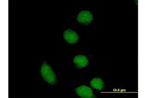 Immunofluorescence (IF) image for anti-Core-binding Factor, Runt Domain, alpha Subunit 2, Translocated To, 2 (CBFA2T2) (AA 1-575) antibody (ABIN522599)