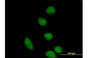 Immunofluorescence of purified MaxPab antibody to CBFA2T2 on HeLa cell. (CBFA2T2 Antikörper  (AA 1-575))