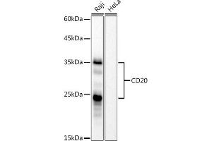 Western blot analysis of extracts of Raji cells, using CD20 antibody (ABIN7268472) at 1:1000 dilution. (CD20 Antikörper)