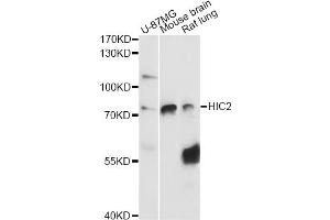 Western blot analysis of extracts of various cell lines, using HIC2 antibody (ABIN6291160) at 1:3000 dilution. (HIC2 Antikörper)