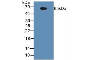 Detection of IL1R1 in Human Raji Cells using Polyclonal Antibody to Interleukin 1 Receptor Type I (IL1R1) (IL1R1 Antikörper  (AA 21-109))