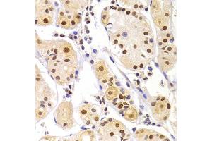 Immunohistochemistry of paraffin-embedded human gastric injury using HNRNPA1 Antibody (ABIN5975570) at dilution of 1/100 (40x lens). (HNRNPA1 Antikörper)