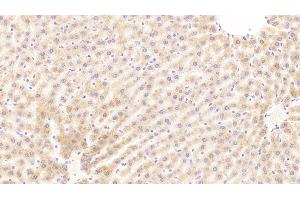 Detection of C5a in Rat Liver Tissue using Polyclonal Antibody to Complement Component 5a (C5a) (C5A Antikörper  (AA 1-77))