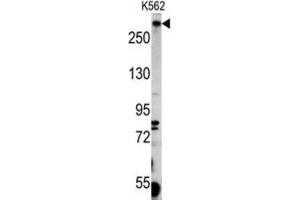 Western Blotting (WB) image for anti-Pericentriolar Material 1 (PCM1) antibody (ABIN3003241) (PCM1 Antikörper)