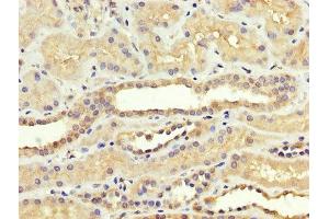 Immunohistochemistry (IHC) image for anti-Sterol Regulatory Element Binding Transcription Factor 1 (SREBF1) (AA 38-201) antibody (ABIN7170778)
