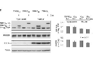 ROS and HMGB1 distribution in TBP/Q36~79 293 cells. (Histone H3.3B Antikörper  (full length))