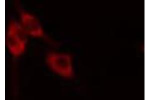 ABIN6268882 staining HeLa cells by IF/ICC. (Fibronectin 1 Antikörper  (C-Term))