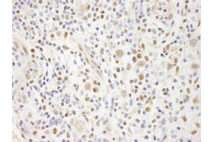anti-E74-Like Factor 1 (Ets Domain Transcription Factor) (ELF1) (AA 569-619) antibody