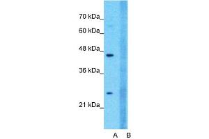 Host:  Rabbit  Target Name:  CLDN18  Sample Type:  Jurkat  Lane A:  Primary Antibody  Lane B:  Primary Antibody + Blocking Peptide  Primary Antibody Concentration:  1ug/ml  Peptide Concentration:  5ug/ml  Lysate Quantity:  25ug/lane/lane  Gel Concentration:  0. (Claudin 18 Antikörper  (C-Term))