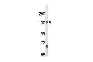 Western blot analysis of CACNA2D1 Antibody in mouse brain tissue lysates (35ug/lane) (CACNA2D1 Antikörper  (N-Term))